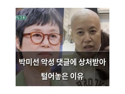 박미선 악성 댓글에 상처받아 털어놓은 이유