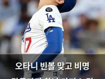 오타니 빈볼 맞고 비명 감독까지 화난 다저스 팀 분위기
