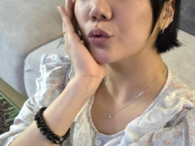고은아 코 재건 수술 후 완전체 비주얼로 화제